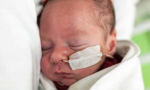 קצבת נכות לילד הסובל מבעיות האכלה והזנה